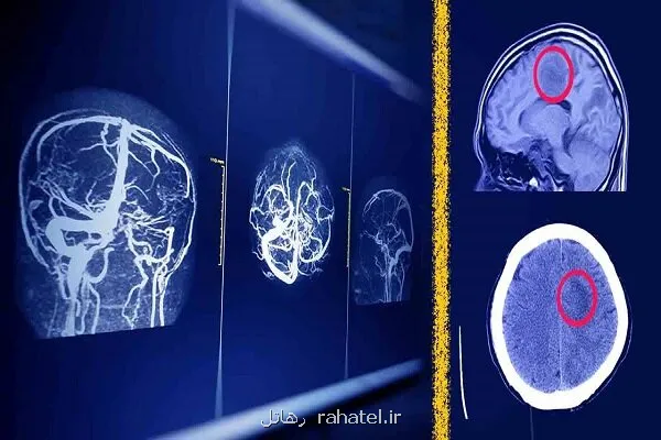 پیشبینی آینده رادیولوژیست ها باوجود هوش مصنوعی